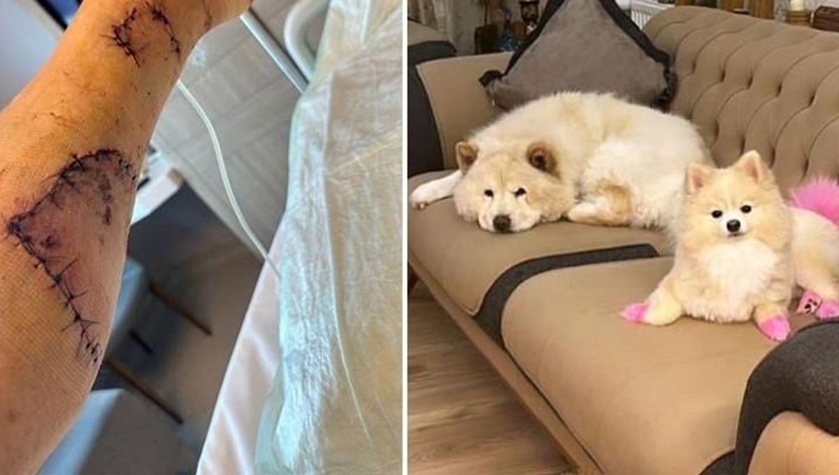Çin Aslanı evdeki diğer köpeği kıskandı sahibini hastanelik etti: Bacağı parçalandı