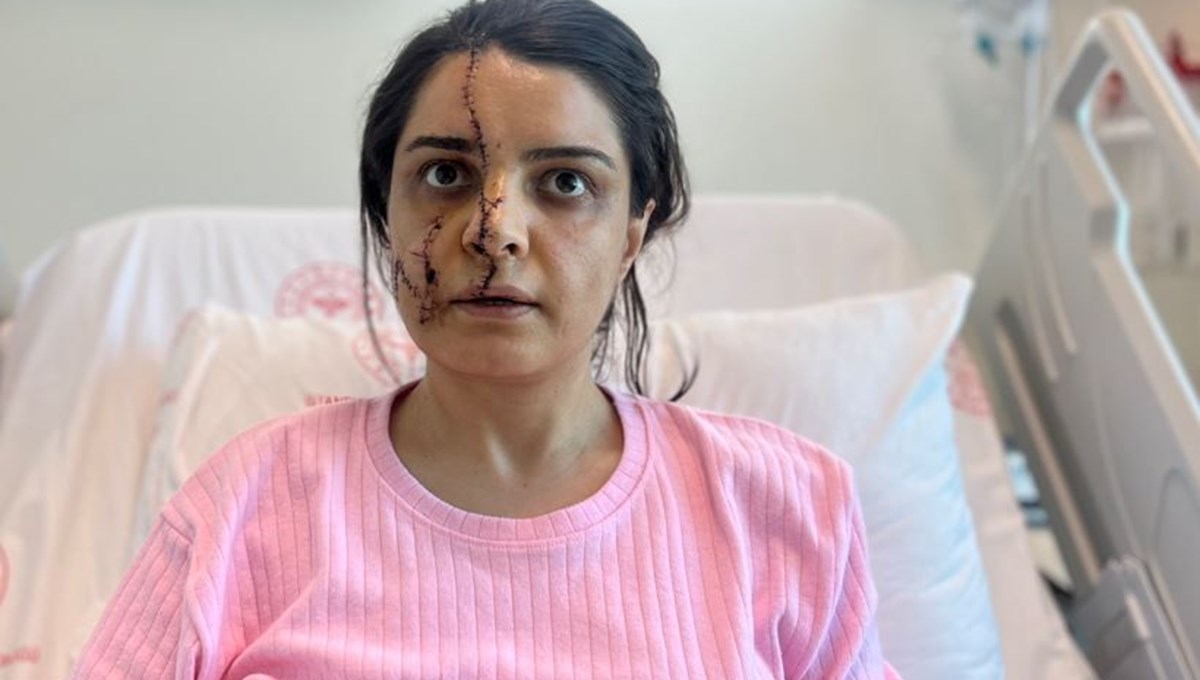 Marmaray'da kadın görevliye saldırı! 40 dikiş atılan kadın dehşet anlarını anlattı