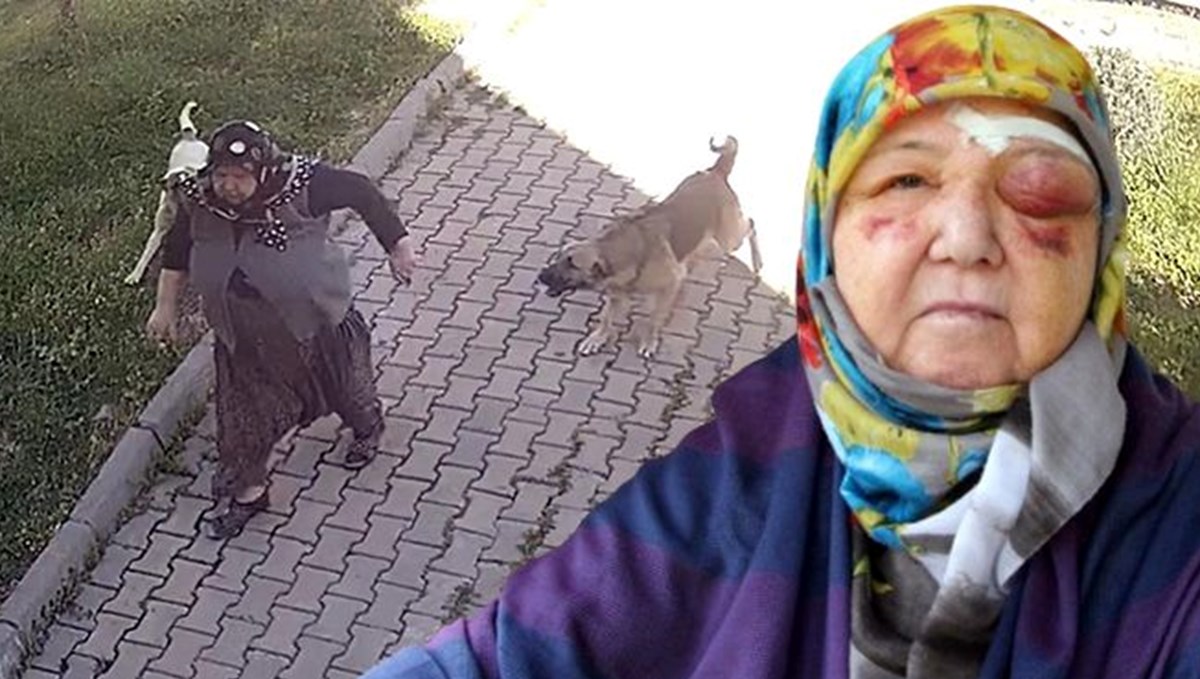 Köpeklerden kaçarken düşen yaşlı kadın yaralandı: O anlar kamerada